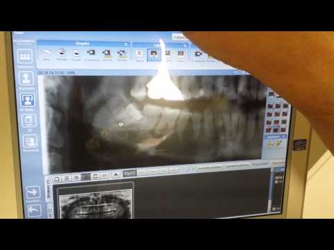 Zahnarzt Dr. Achim Schmit erklärt sein DVT 3D Röntgen | creative zahnärzte