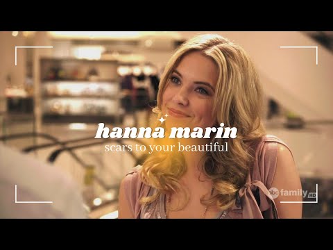 scars to your beautiful - hanna marin