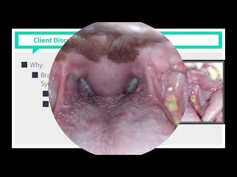 VICE Rounds - Brachycephalic Airway Syndrome (See Description For How to Access More Videos)