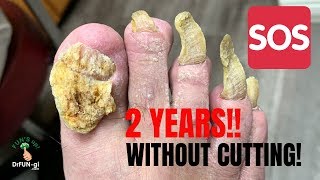 GRINDING DOWN LONG AND THICK NAILS