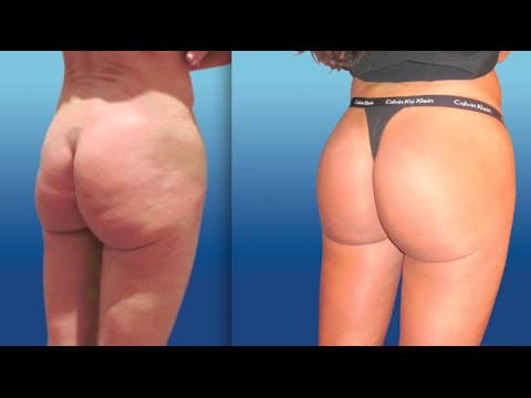 Come migliorare la potenza di YouTube Migliorare la potenza sessuale maschile