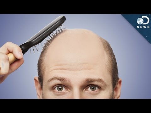 Why Do Men Go Bald?
