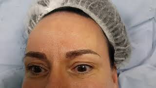 Post Chemo Realism Eyebrows Restoration by El Truchan @ Perfect Definition