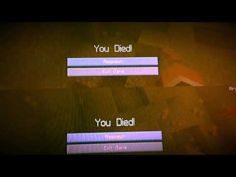 MLG - Cheeky Kid Gets Rekt