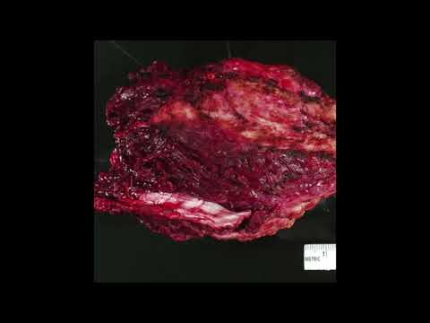 James Holden - Lumpette (Arandel's Shoegaze Tool)