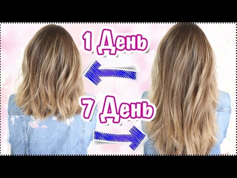 Веснушки минус мп3 Почему у ребёнка пигментные пятна на коже