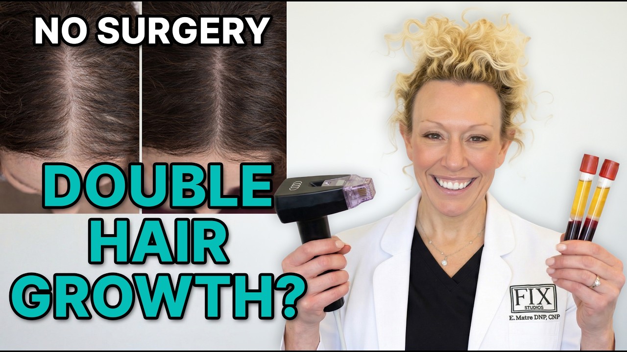 7 Reasons PRP + Morpheus8 Is Changing Hair Restoration Cincinnati