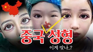 난리 난 중국 성형sns영상!! '누가 만족하는 사람이 있으려나..?