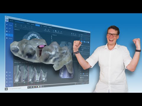 Find the perfect surgical guide in just a few minutes with the Romexis