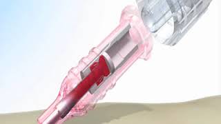 Product video: ViaValve Safety IV Catheters
