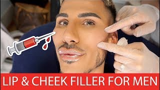 LIP & CHEEK FILLER FOR MEN | FLAWLESS COSMETIC