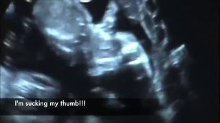 Baby Girl or Baby Boy