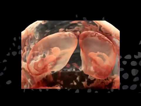 УЗИ в режиме 3D и 4D