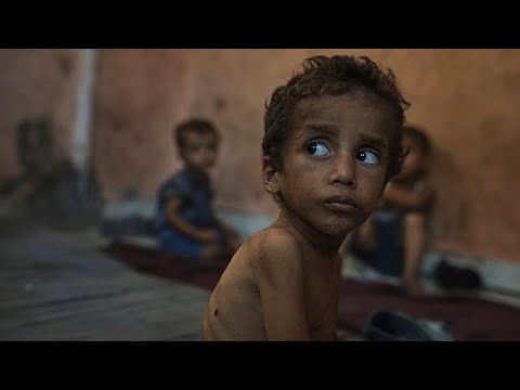 ‘From bad to worse’: Gaza hospital faces surge in child hunger deaths