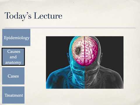 Aula 2 - Acidente Vascular Cerebral/Encefálico (AVC/AVE)