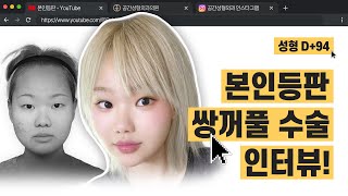 3개월만에 이렇게 변신 가능?ㅣ쌍수 숏츠 주인공 본인등판 리얼후기
