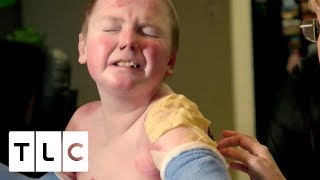 Boy&#39;s Skin is Falling Off | Body Bizarre