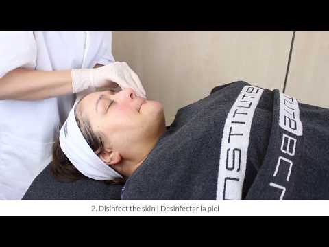 BCN Heal: how it works on the skin | BCN Heal: cómo actúa en la piel