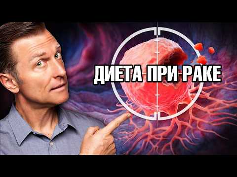 Что делать при раке толстой кишки 4 стадии: стратегии и питание🙌