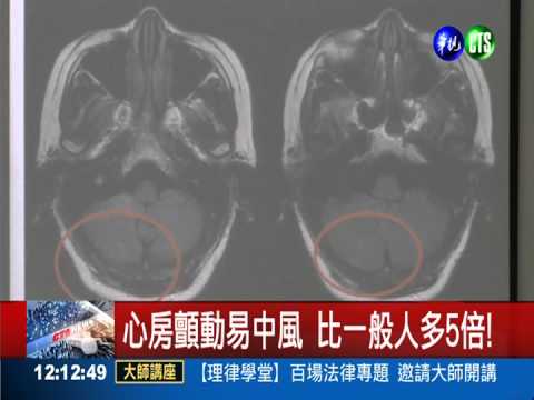 心房顫動易中風 比一般人多5倍!