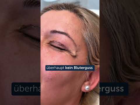 Mehmet Akbas-33