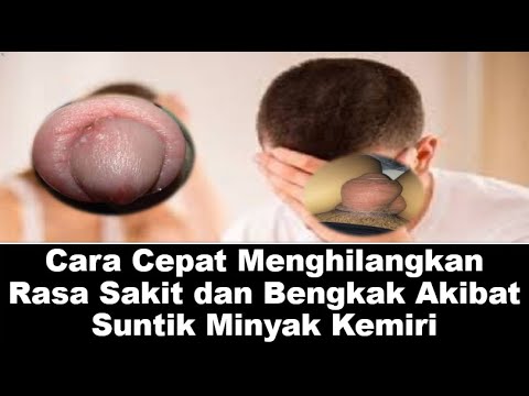 Cara Cepat Menghilangkan Rasa Sakit dan Bengkak Akibat Suntik Minyak Kemiri