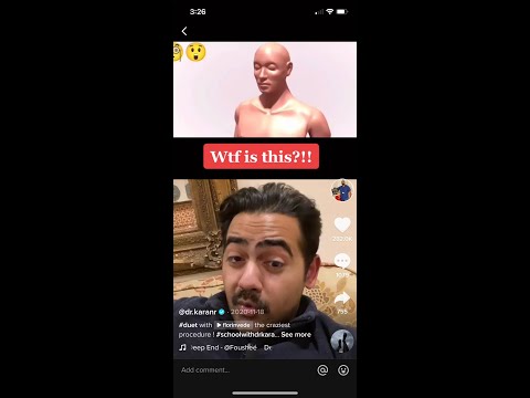 Doctor reacts to crazy brain surgery! #shorts