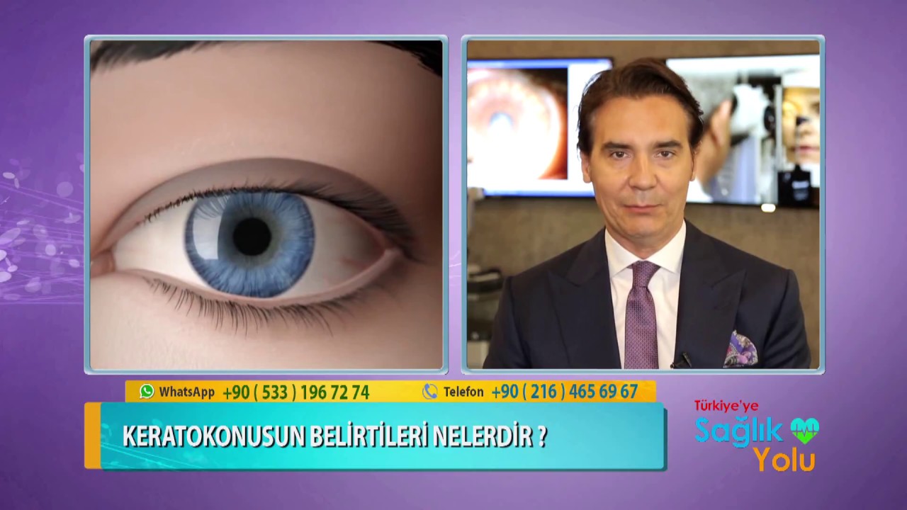 Keratokonus Nasıl Tedavi Edilir?