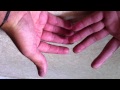 Combattre les mains moites - Solutions contre la transpiration: Astuce contre les mains moites