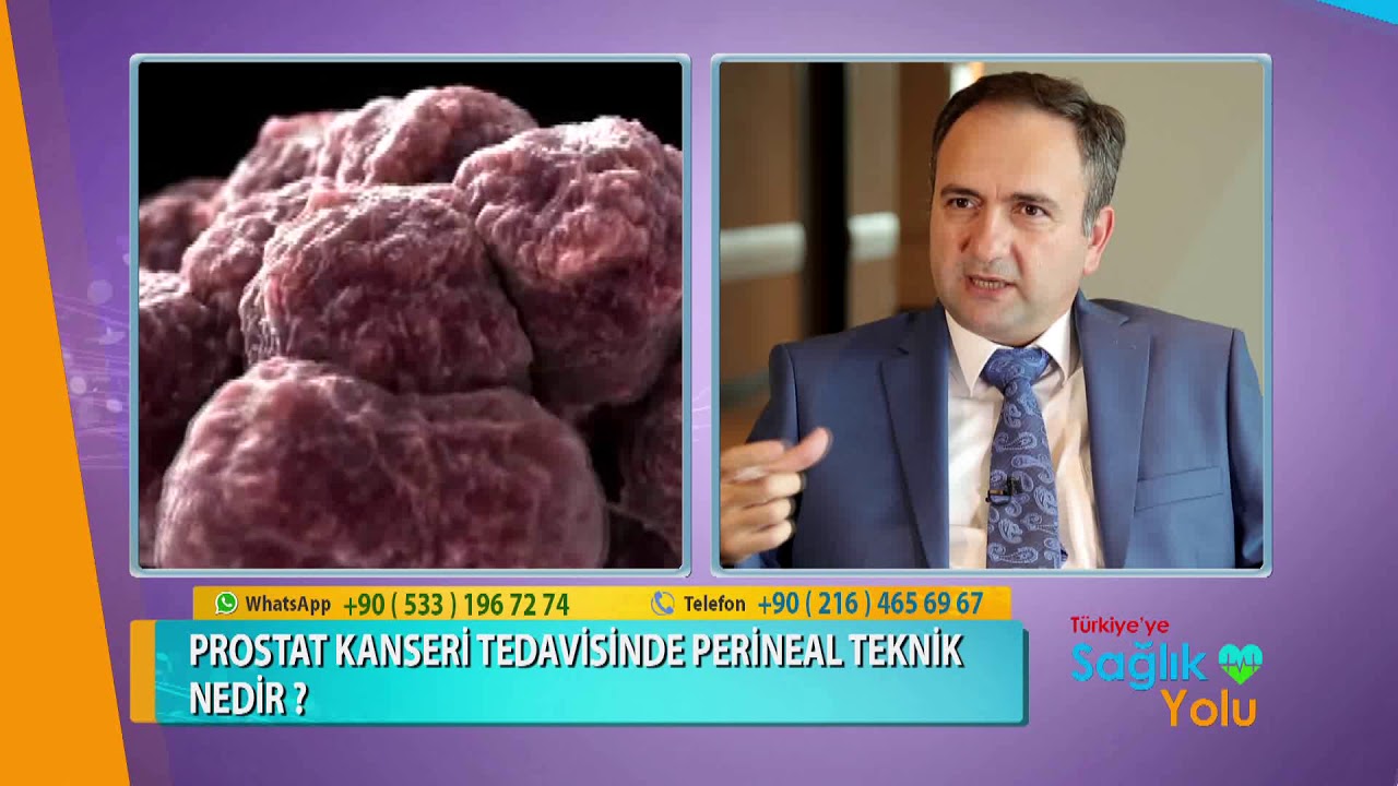 Prostat Kanserindeki Gelişmeler Nelerdir?