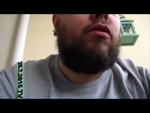 Kävävin lääkärissä