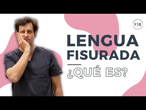 👅¿Qué es la LENGUA FISURADA o AGRIETADA? Soluciones para las GRIETAS de la LENGUA😋