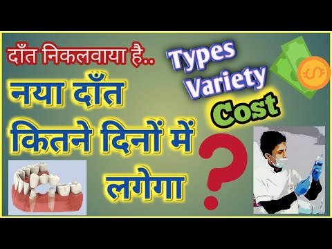 Options to Replace Missing Teeth, Fix Dent Cap Bridge, RPD Price | When and how are Nakli denture...