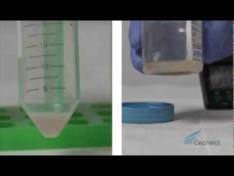 Cepheid's Xpert® MTB/RIF Training Video