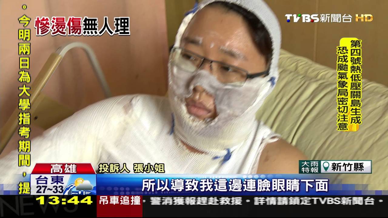 熱水壺煮咖啡燙傷 導遊竟叫計程車送醫