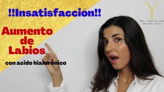 3 casos de INSATISFACCIÓN en el tratamiento de AUMENTO DE LABIOS con ACIDO HIALURONICO