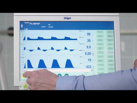 Einstellen der Beatmung bei der der Dräger Evita Infinity V500