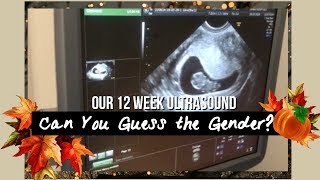 My 12 Week Ultrasound!!! | Can You Guess the Gender by the Heart Rate???