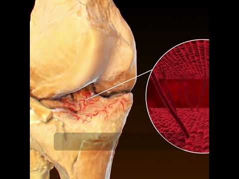 Current Statistics on Bone Cancer Incidence in India