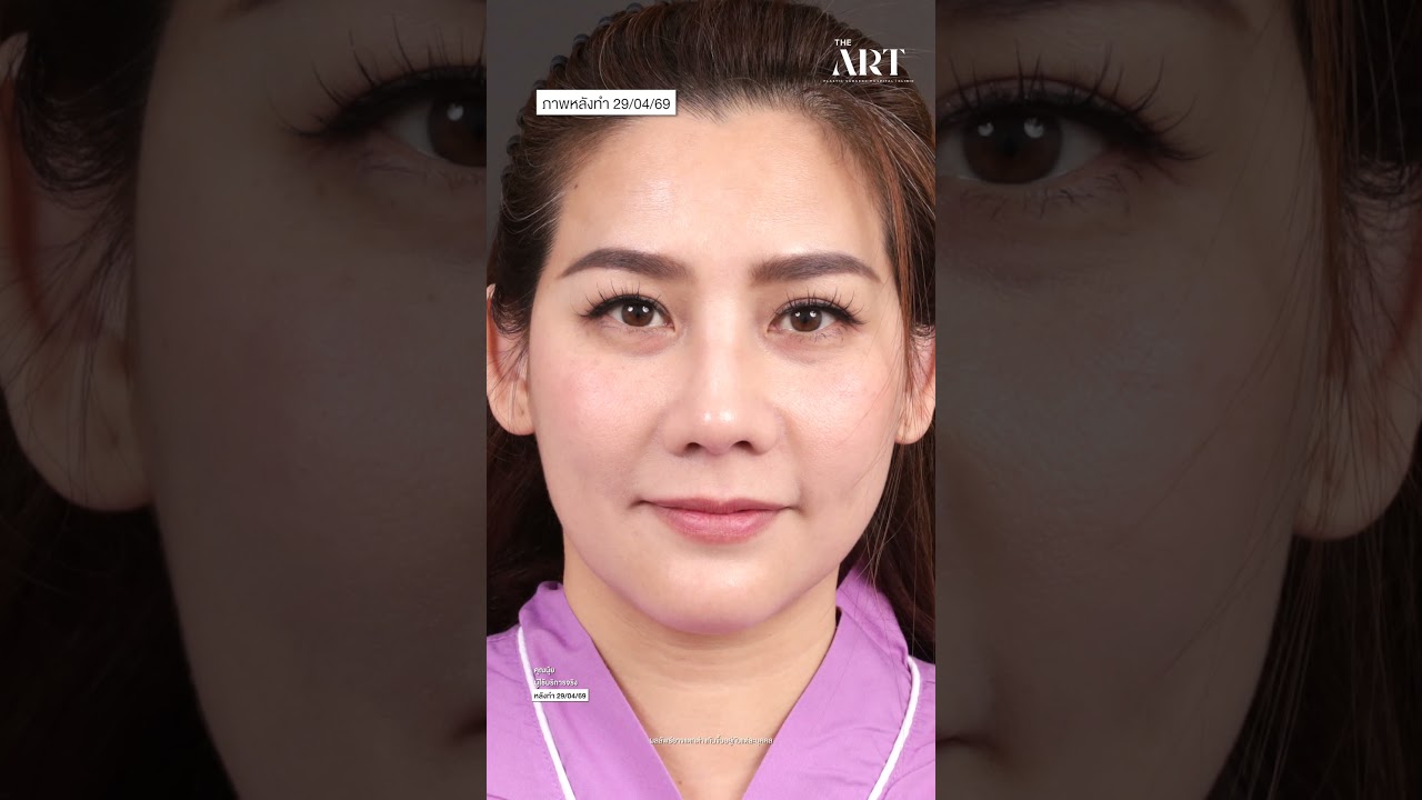 Ms.Nui from TV Surgery Wars EP.2 😯