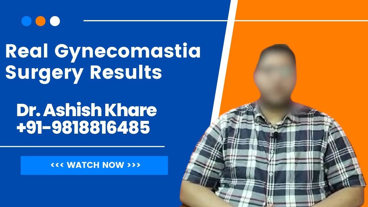 gynecomastia surgery results 