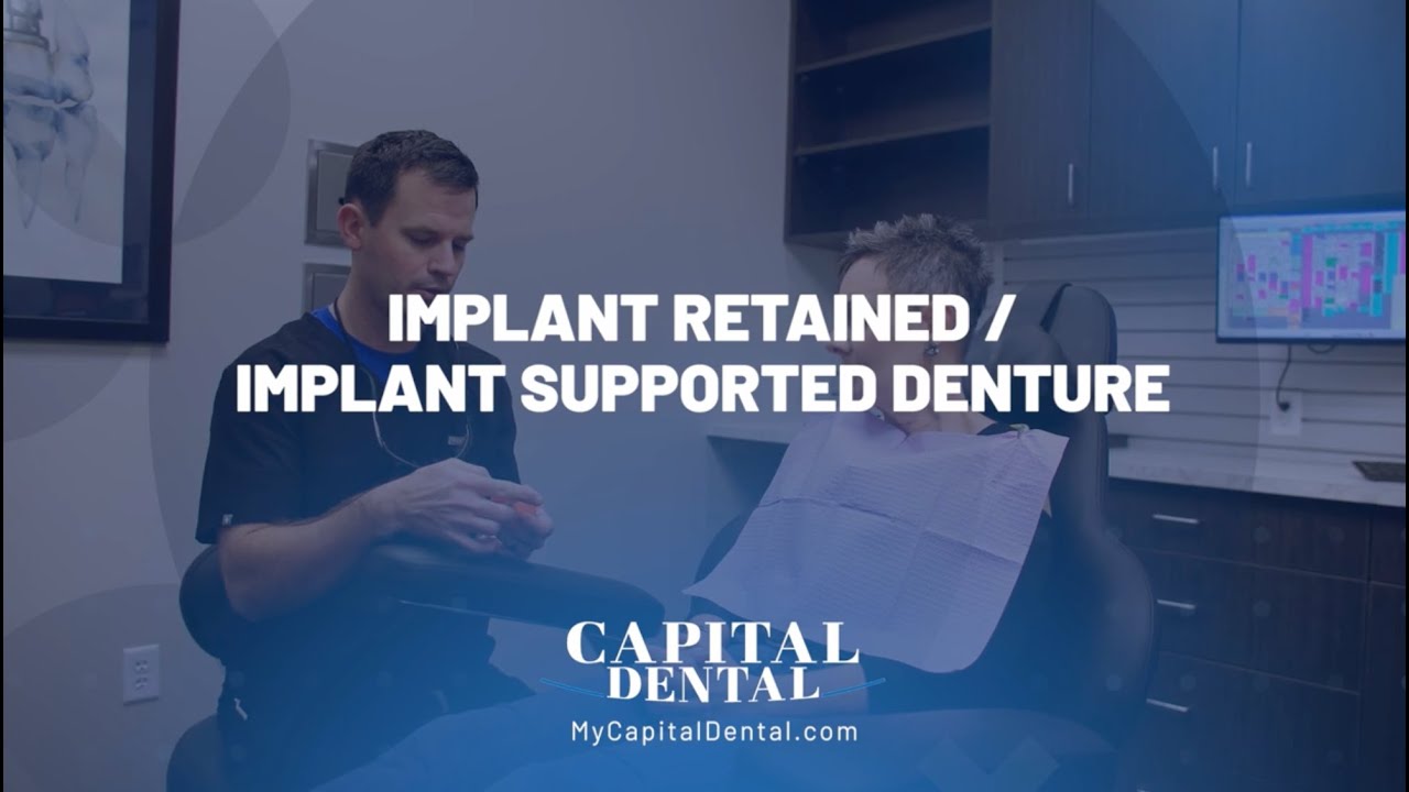 Implant retained VS Implant Supported Denture