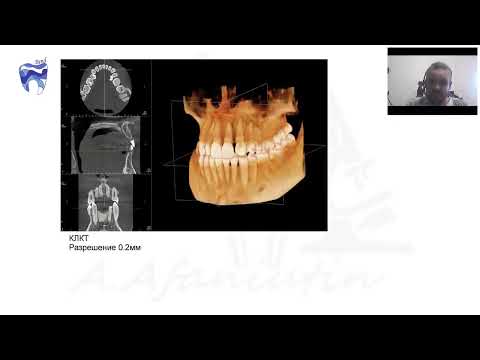 Рентгенодиагностика для эндодонтиста (начало 5:55)