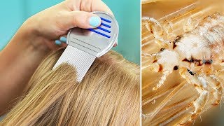 LiCE iN OUR HOUSE? | Tips for Natural Lice Removal &amp; Treatment