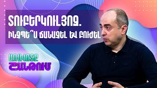 Թոքաբանության ազգային ինստիտուտի բժիշկ Հակոբ Աճեմյան