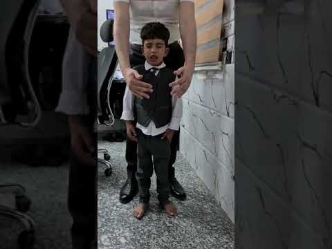 Case 186 Romberg sign ,sensory ataxia ,vestibular ataxia,7 yr. Unsteady gait dr zuhair