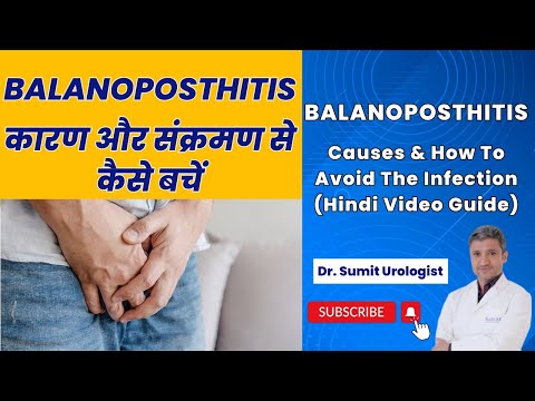 Balanoposthitis Causes & How To Avoid The Infection (Hindi Video Guide) | Dr. Sumit Sharma Urologist