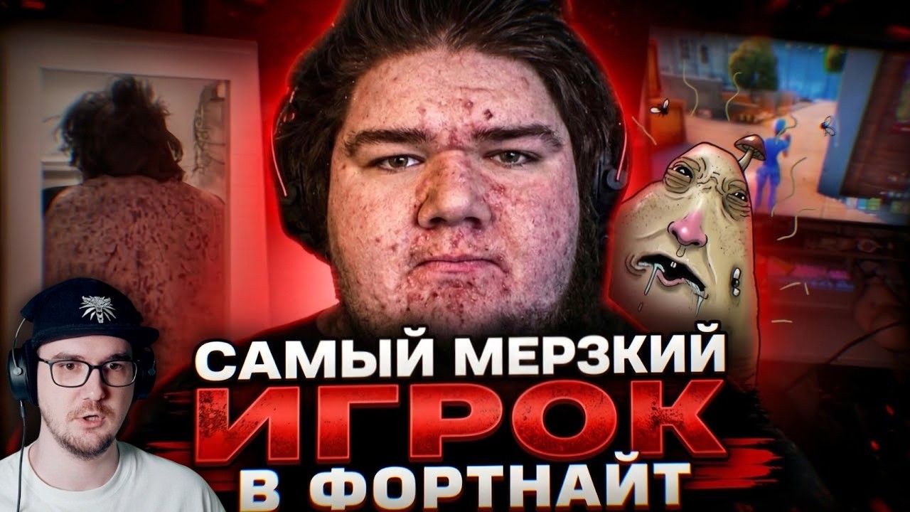 ОН ИГРАЕТ 20 ЧАСОВ В СУТКИ И УЖЕ ГНИЁТ ЗАЖИВО! САМЫЙ МЕРЗКИЙ ИГРОК В ФОРТНАЙТ Te