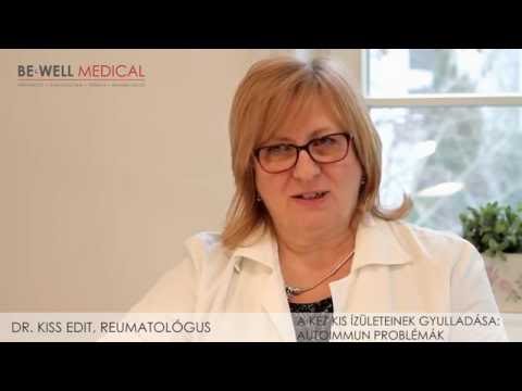 Rheumatoid arthritis kéz gyógyszeres kezelése