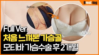윈느성형외과 유튜브 영상 썸네일
